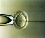 Embriyo transferi ve embriyo bağışı