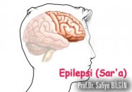 Epilepsi (sara) hastalığı nedir, tedavisi nasıldır?