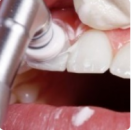 Diş taşı temizliğinin dişlere zararı var mıdır?