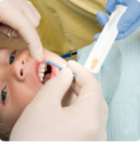 Fissür örtücü (diş aşısı) nedir? nasıl uygulanır?
