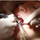 Kanal tedavisi nedir? ömrü ne kadardır ve kanal tedavisi yapılmış bir diş tekrar iltihaplanabilir mi?