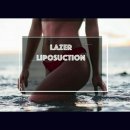 Lazer liposuction hangi bölgelere yapılır?