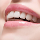 Estetik diş hekimliği (diş estetiği)