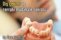 Cerrahi müdahale ve diş çekimi sonrası