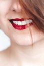 Gülümsemenizi ertelemeyin!! dental implantlar ile sağlıklı mutlu gülüşler mümkün!!!