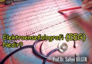 Elektroensefalografi (eeg) nedir?