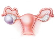 Yumurtalık kisti nedir? yumurtalık kisti ağrı yapar mı? sol kasık ağrısı yumurtalık kistine bağlı mıdır?