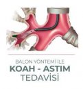 Koah balon tedavisi ve yararları