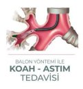 Koah balon tedavisi ve yararları