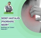 Sedef hastalığı (psoriasis) nedir?