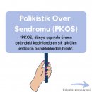 Polikistik over sendromu (pkos) / tanı ve tedavi yöntemleri