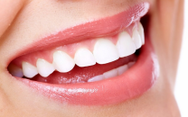 Güzel gülüşlerin sırrı: diş beyazlatma