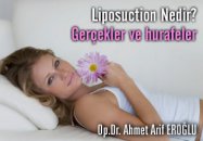 Liposuction nedir? gerçekler ve hurafeler