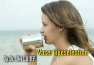 Vaser liposelection