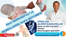 Akut hidrosefali ve bebeklerde (yenidoğanda) kafa büyümesi | prof.dr. alper karaoğlan