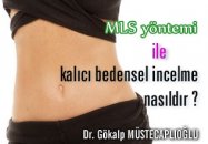 Mls yöntemi ile kalıcı bedensel incelme nasıldır ?