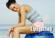 Liposuction (liposakşın)