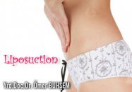 Liposuction (yağ alma)
