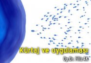 Kürtaj ve uygulaması