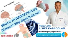 What is hydrocephalus disease? why does ıt occur?