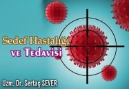 Sedef hastalığı (psoriazis) ve tedavisi