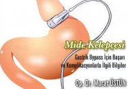 Mide kelepçesi ve gastrik bypass için başarı ve komplikasyonlarla ilgili bilgiler