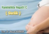Hamilelikte hepatit c ( sarılık )