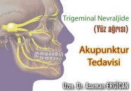 Trigeminal nevraljide (yüz ağrısı) akupunktur tedavisi