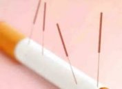 Sigarayı bırakmaya akupunturun etkisi
