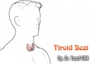 Tiroid bezi ne zaman normal değildir ?