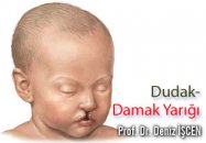 Dudak-damak yarığı ile doğmuş çocuklarda