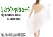 Labioplasti (iç dudakların tamiri-genital estetik)