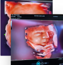 4 boyutlu ayrıntılı ultrason