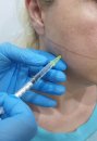 Bruksizm (diş sıkma) nedir? bruksizm belirtileri ve tedavisi