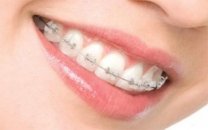 Ortodonti ve çene hastalıkları