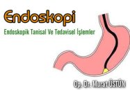 Endoskopi-endoskopik tanısal ve tedavisel işlemler