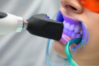 Diş beyazlatma (bleaching): yöntemler, etkiler ve önlemler