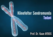 Klinefelter sendromunda tedavi