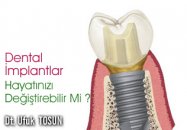 Dental implantlar hayatınızı  değiştirebilir mi?