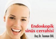 Endoskopik sinüs cerrahisi (esc)