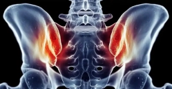 Sakroiliak eklem ağrısı: bel ağrısının bilinmeyen nedeni!