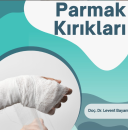 Parmak kırıkları,