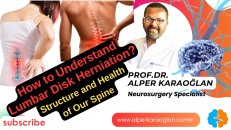 How to understand lumbar dısk hernıatıon / structure & health of our spıne