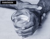 Parkinson hastalığı