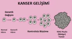 Kanser ameliyatı cerrahisi nedir ?