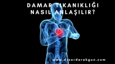 Damar tıkanıklığı nasıl anlaşılır?