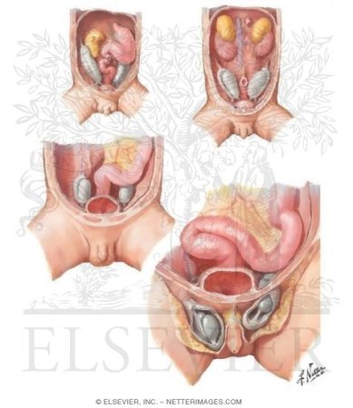İnmemiş testis nedir?