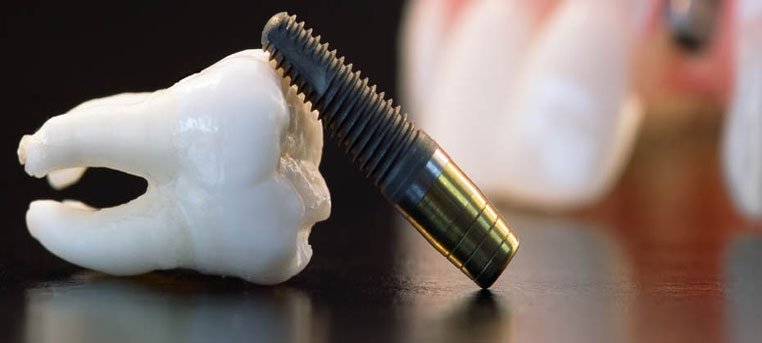Diş çekimi ve cerrahi işlemler sonrası tavsiyeler