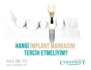 Hangi implant markası iyidir ?