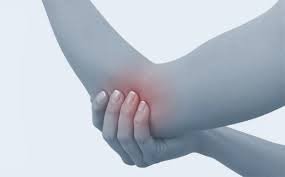Tenisçi dirseği (lateral epikondilit) ve golfçü dirseği (medial epikondilit)
